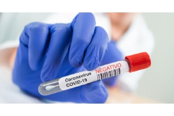 Los menores no acompañados de Alhama, negativos por Covid-19 en las pruebas PCR